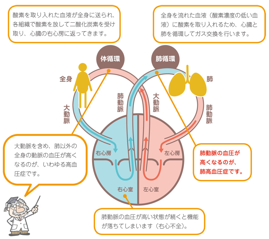 高血圧 症 肺 肺高血圧症